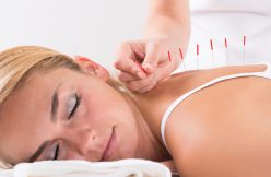 acupuncturists
