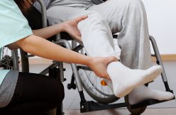 Burn Injuries